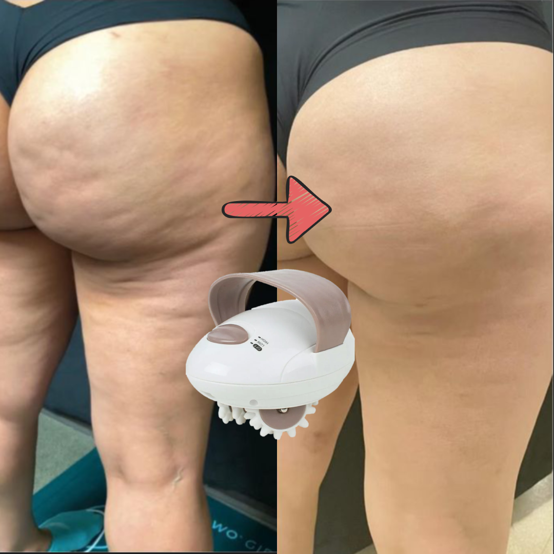 MASAJEADOR ANTICELULITIS